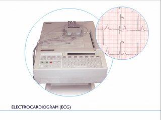 Patient ECG