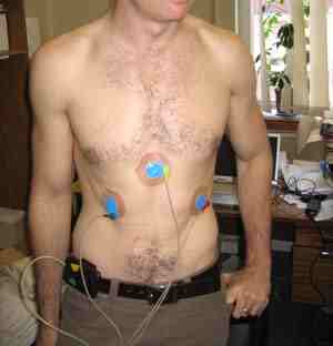 Holter Monitor - 24 hour ECG